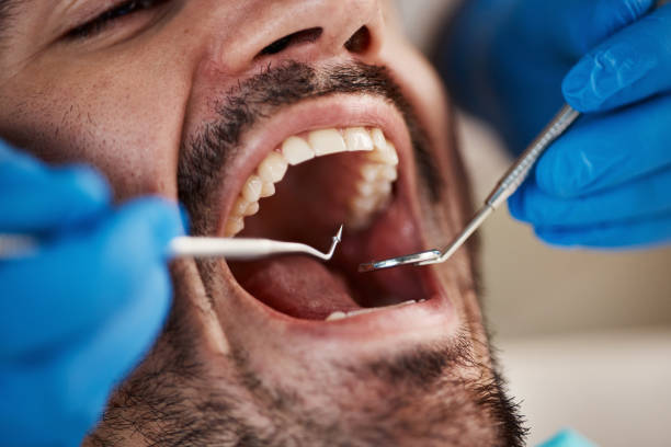 Best Emergency Treatment for Toothache in Clear Lake, IA